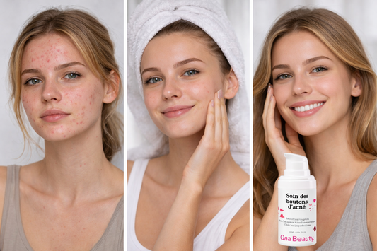 Tes imperfections ne sont pas un manque d’hygiène