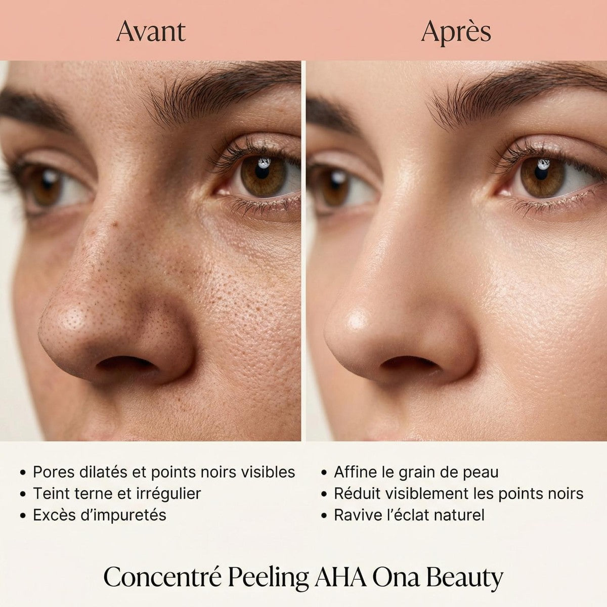 Concentré peeling AHA - OnaBeauty