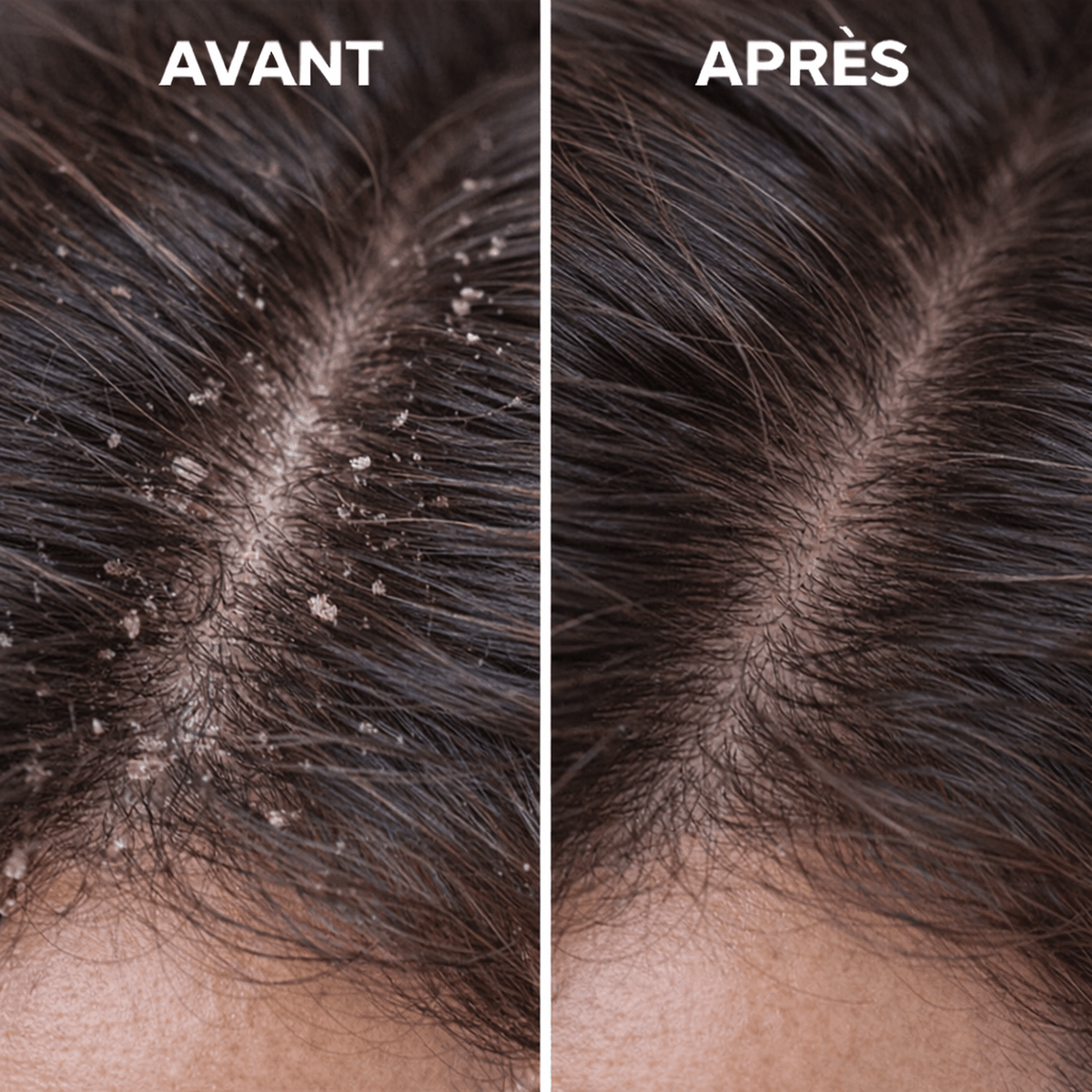Gommage botanique du cuir chevelu - OnaBeauty