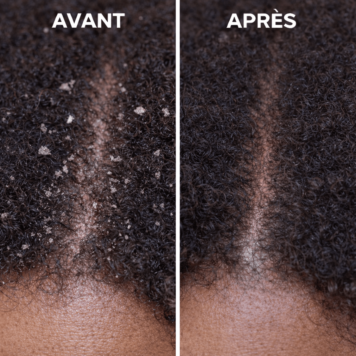 Gommage botanique du cuir chevelu - OnaBeauty
